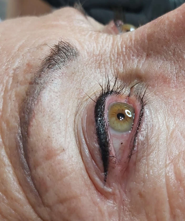 Micropigmentación en Biobella2